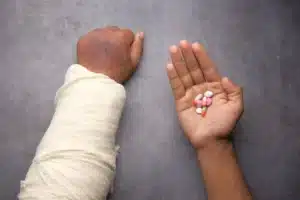 Arm with cast