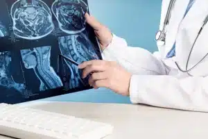 Doctor pointing at brain and neck x-rays