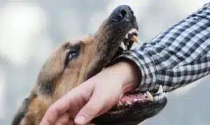 Dog biting person_s forearm